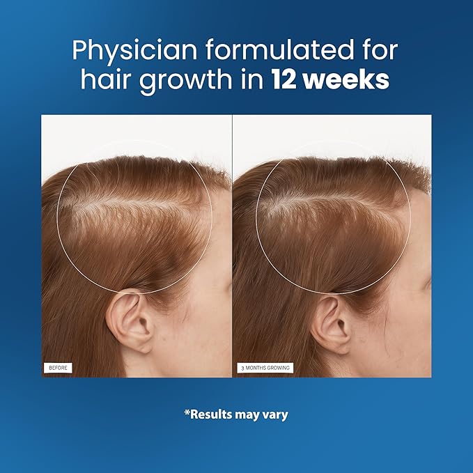 Luvelle™ Hair Regrowth Serum